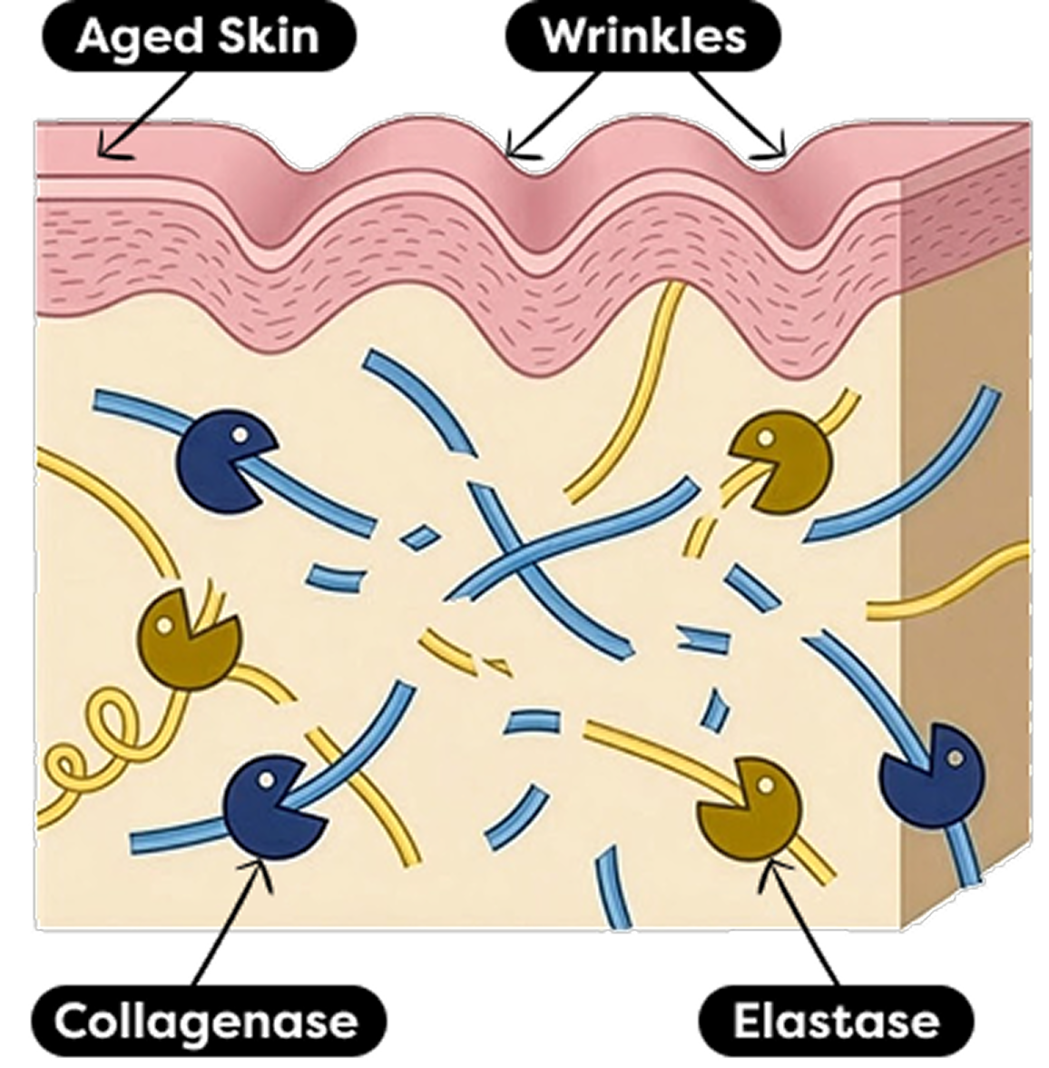 Aged skin — collagenase and elastase enzyme breakdown