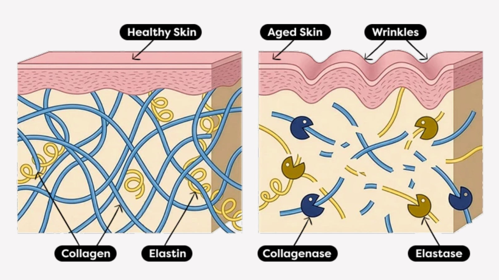 The accelerating breakdown process in aging skin